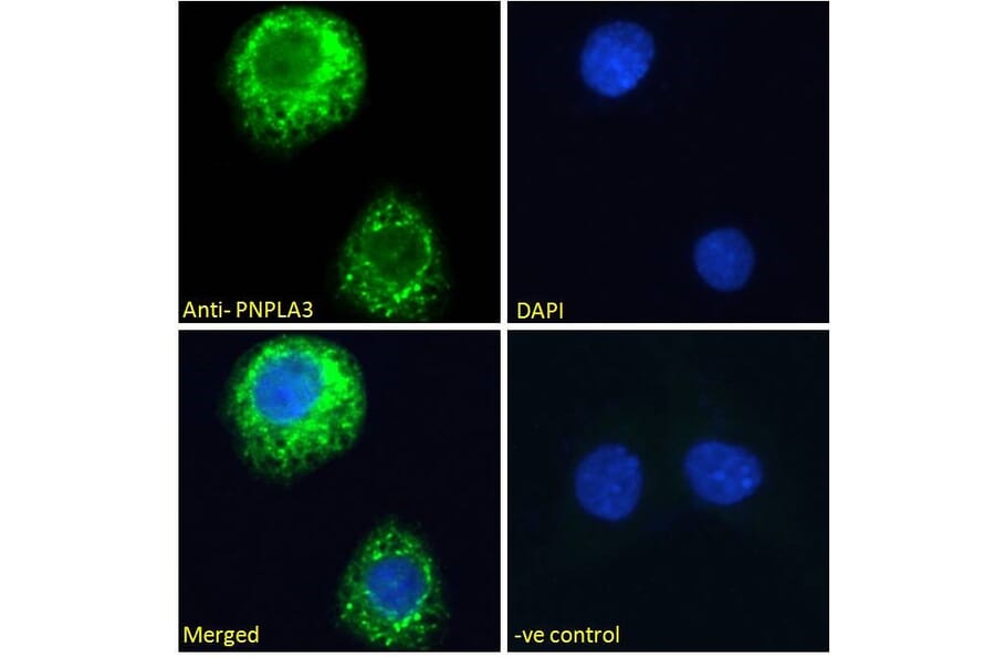 Immunofluorescence - Anti-PNPLA3 Antibody (A82487) - Antibodies.com