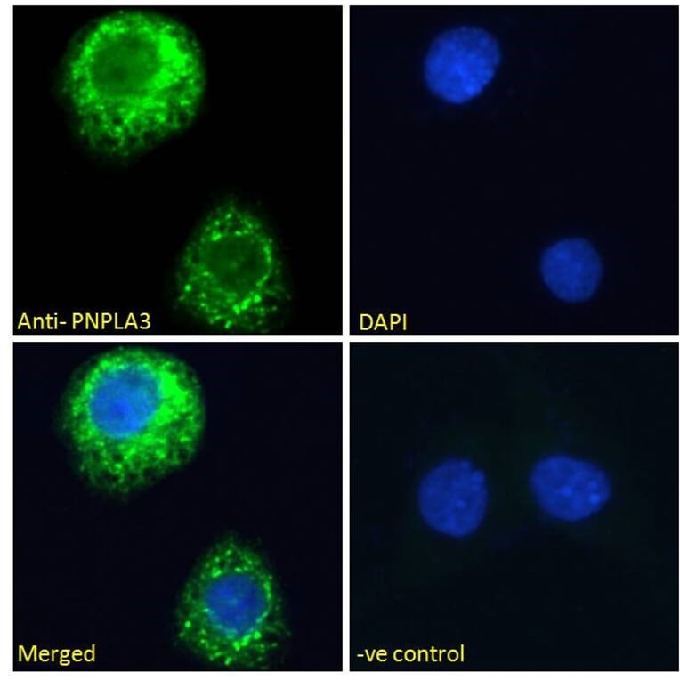 Immunofluorescence - Anti-PNPLA3 Antibody (A82487) - Antibodies.com