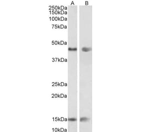 Western Blot - Anti-PNPLA3 Antibody (A82487) - Antibodies.com