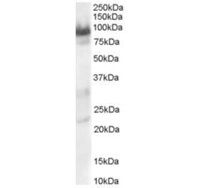 Western Blot - Anti-TRAK1 Antibody (A82488) - Antibodies.com