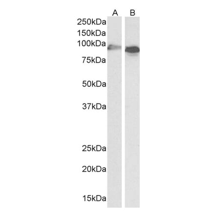 Western Blot - Anti-CYP1A1 Antibody (A82489) - Antibodies.com