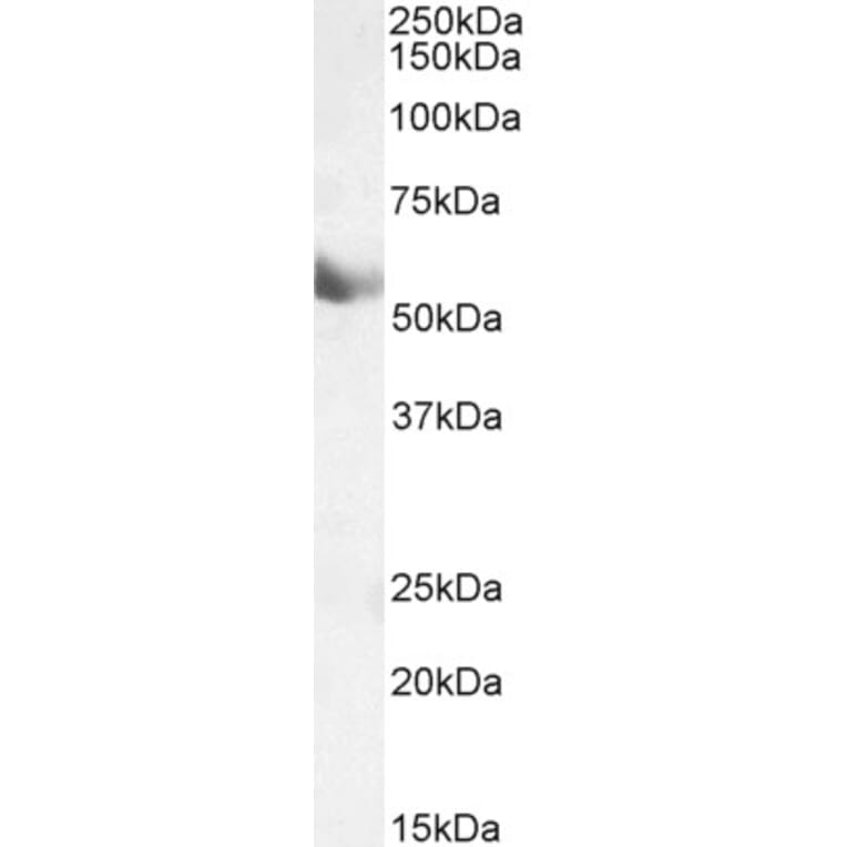 Western Blot - Anti-CYP1A1 Antibody (A82490) - Antibodies.com