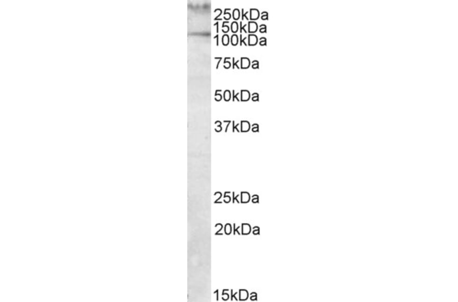 Western Blot - Anti-Talin 1 Antibody (A82491) - Antibodies.com