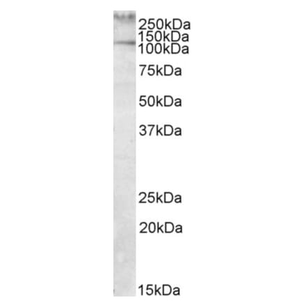 Western Blot - Anti-Talin 1 Antibody (A82491) - Antibodies.com