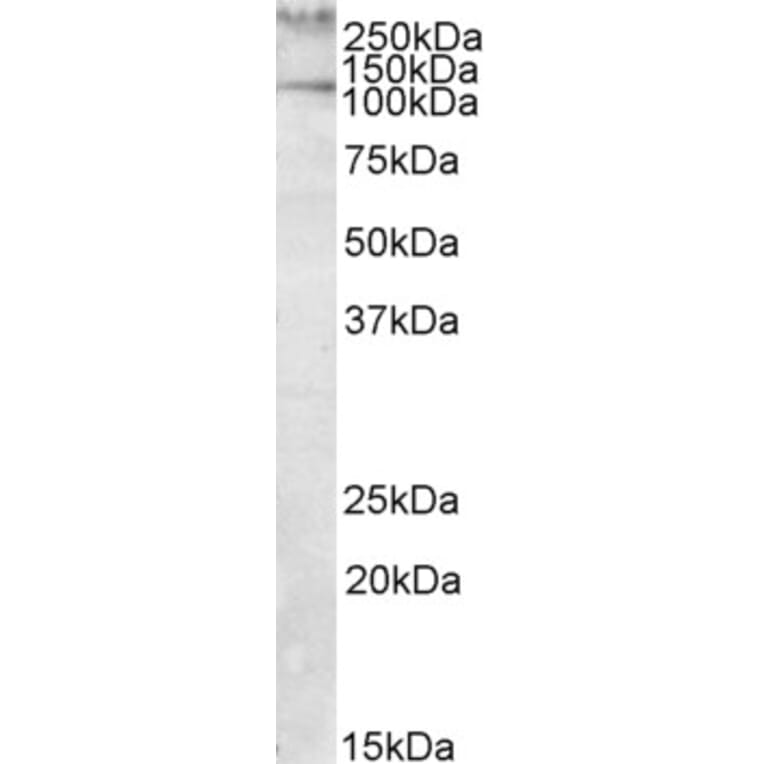 Western Blot - Anti-Talin 1 Antibody (A82491) - Antibodies.com