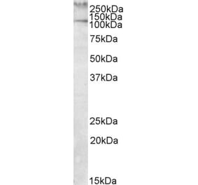 Western Blot - Anti-TLN1 Antibody (A82491) - Antibodies.com
