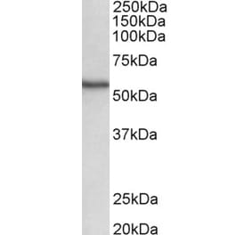 Western Blot - Anti-STK38 Antibody (A82492) - Antibodies.com