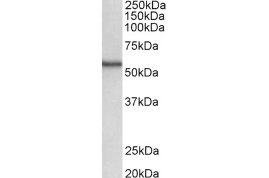 Western Blot - Anti-STK38 Antibody (A82492) - Antibodies.com
