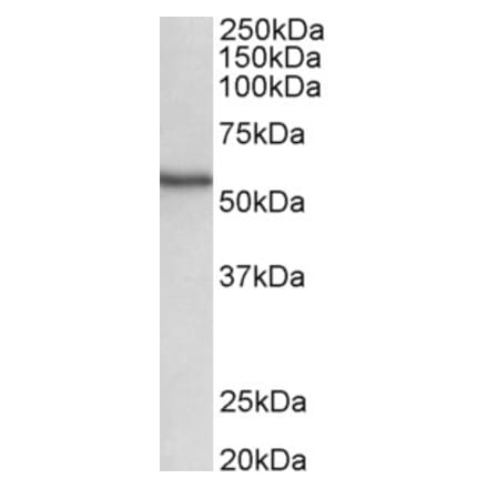 Western Blot - Anti-STK38 Antibody (A82492) - Antibodies.com