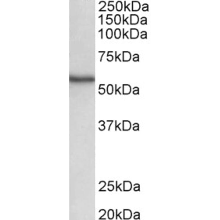 Western Blot - Anti-STK38 Antibody (A82492) - Antibodies.com