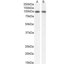 Western Blot - Anti-STAT5a Antibody (A82493) - Antibodies.com