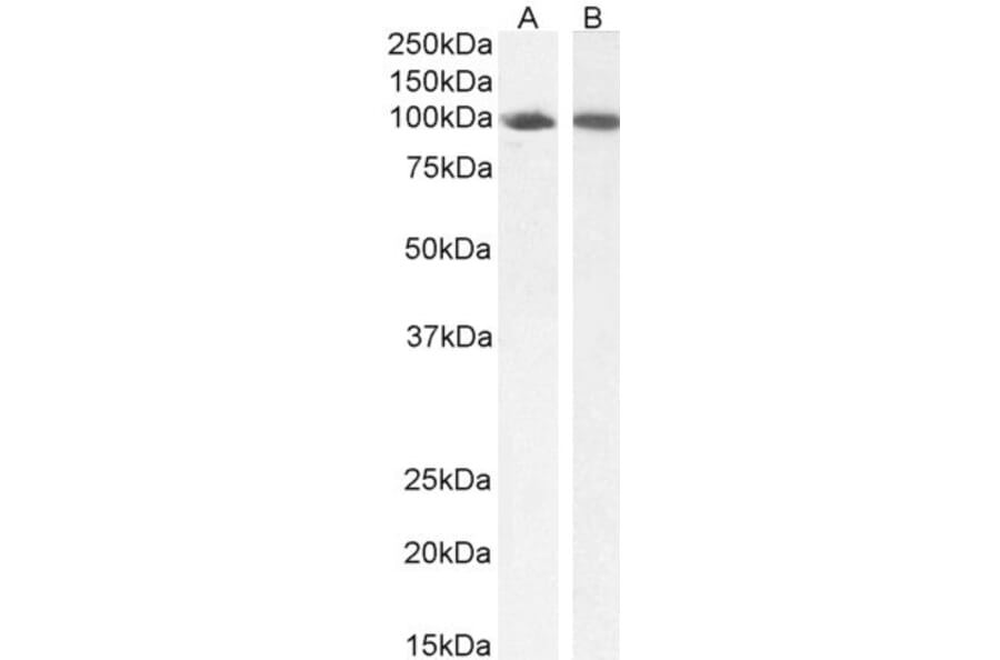 Western Blot - Anti-STAT5a Antibody (A82493) - Antibodies.com