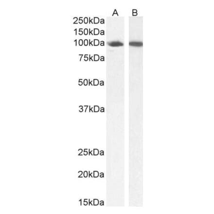 Western Blot - Anti-STAT5a Antibody (A82493) - Antibodies.com