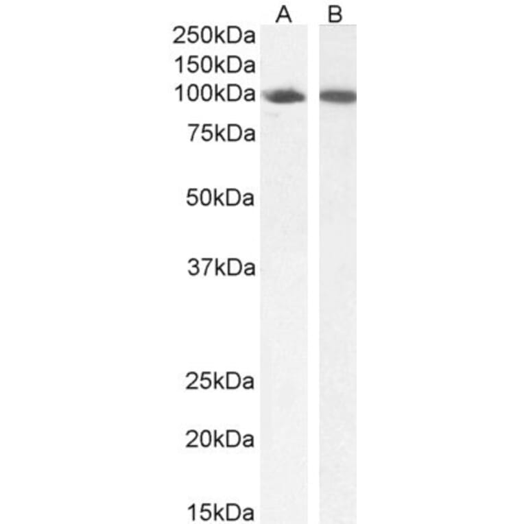 Western Blot - Anti-STAT5a Antibody (A82493) - Antibodies.com