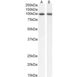 Western Blot - Anti-STAT5a Antibody (A82493) - Antibodies.com