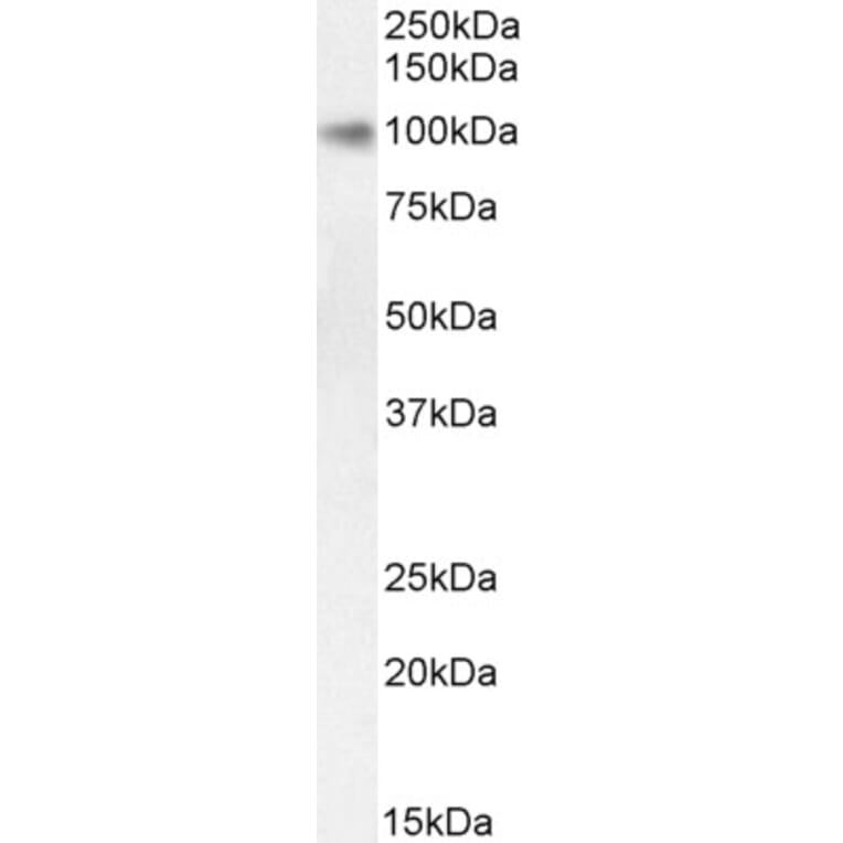 Western Blot - Anti-STAT5a Antibody (A82493) - Antibodies.com