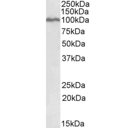 Western Blot - Anti-STAT5a Antibody (A82494) - Antibodies.com