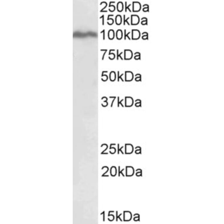 Western Blot - Anti-STAT5a Antibody (A82494) - Antibodies.com