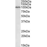 Western Blot - Anti-STAT5a Antibody (A82494) - Antibodies.com