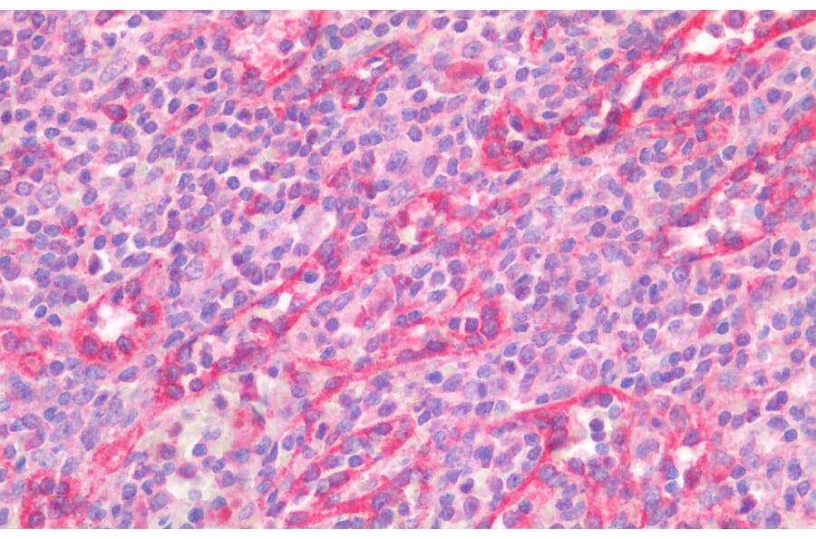Immunohistochemistry - Anti-STAT5a Antibody (A82494) - Antibodies.com