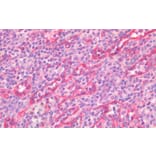 Immunohistochemistry - Anti-STAT5a Antibody (A82494) - Antibodies.com