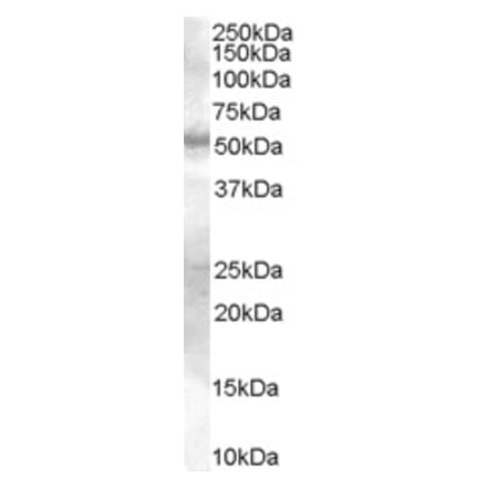 Western Blot - Anti-SMAD9 Antibody (A82495) - Antibodies.com