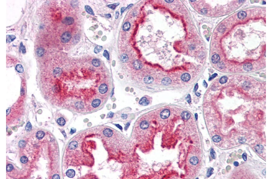 Immunohistochemistry - Anti-SMAD9 Antibody (A82495) - Antibodies.com