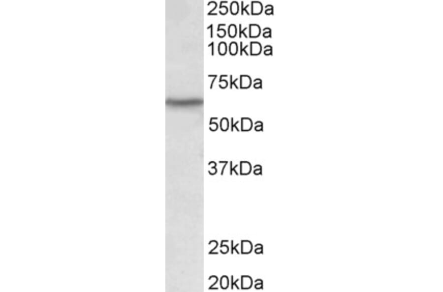 Western Blot - Anti-Lck Antibody (A82497) - Antibodies.com
