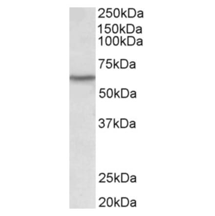 Western Blot - Anti-Lck Antibody (A82497) - Antibodies.com