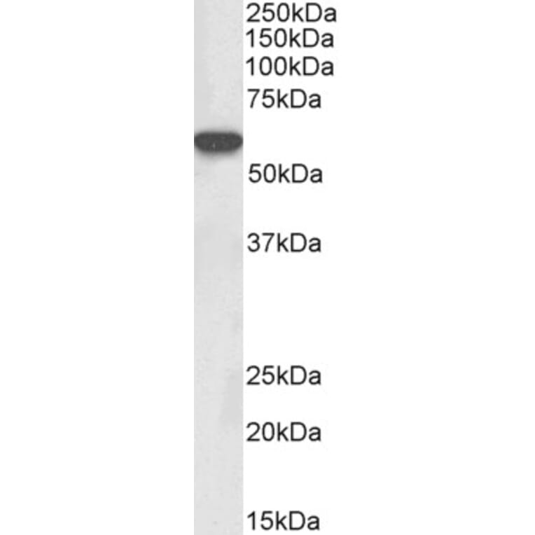 Western Blot - Anti-Lck Antibody (A82497) - Antibodies.com