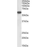 Western Blot - Anti-Lck Antibody (A82497) - Antibodies.com