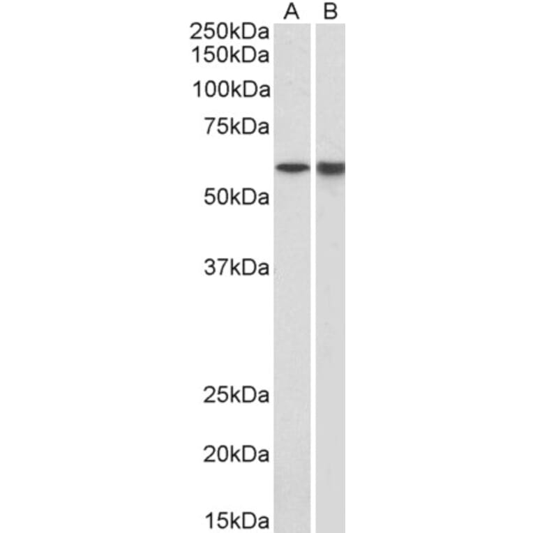 Western Blot - Anti-Lck Antibody (A82497) - Antibodies.com