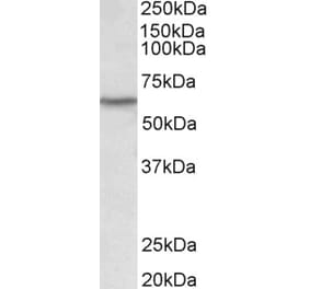 Western Blot - Anti-LCK Antibody (A82497) - Antibodies.com