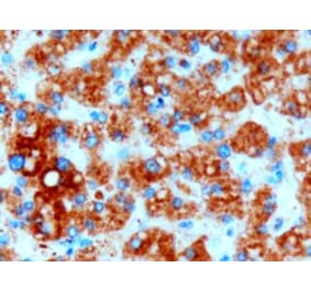 Immunohistochemistry - Anti-DGAT2 Antibody (A82499) - Antibodies.com