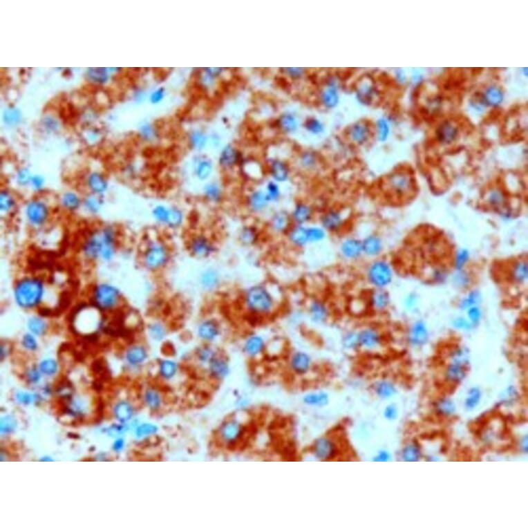 Immunohistochemistry - Anti-DGAT2 Antibody (A82499) - Antibodies.com