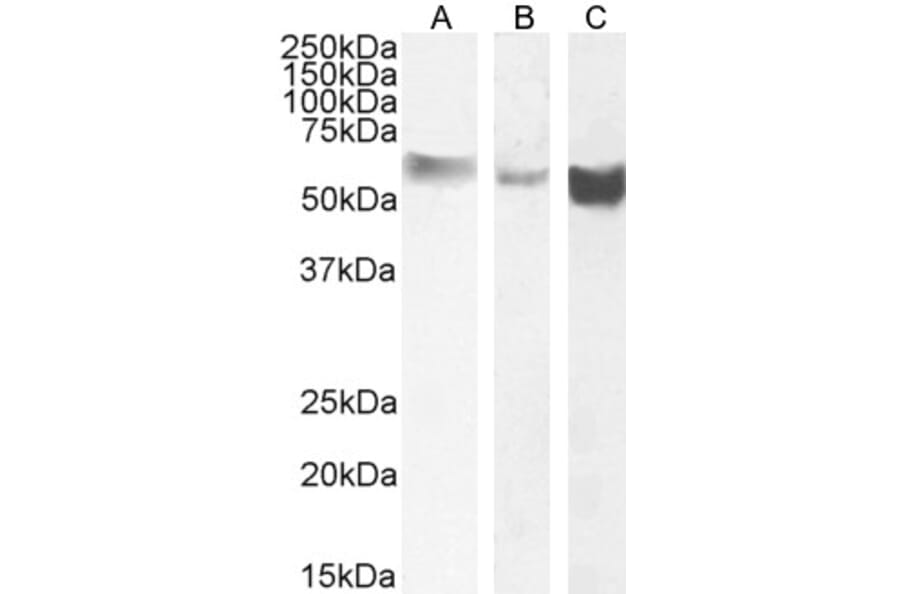 Western Blot - Anti-Monoamine Oxidase B/MAOB Antibody (A82500) - Antibodies.com
