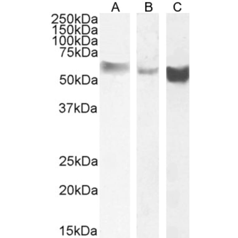 Western Blot - Anti-Monoamine Oxidase B/MAOB Antibody (A82500) - Antibodies.com