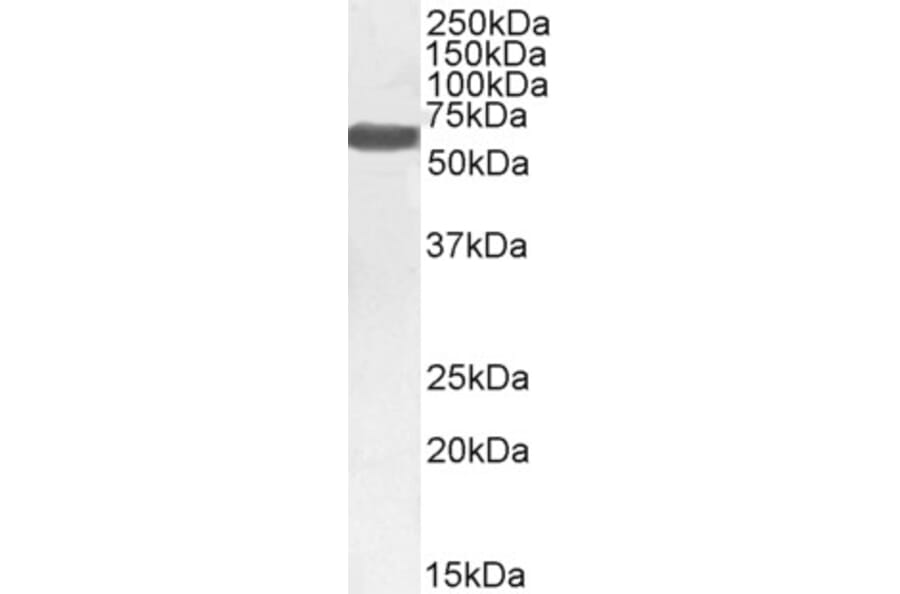Western Blot - Anti-Monoamine Oxidase B/MAOB Antibody (A82500) - Antibodies.com