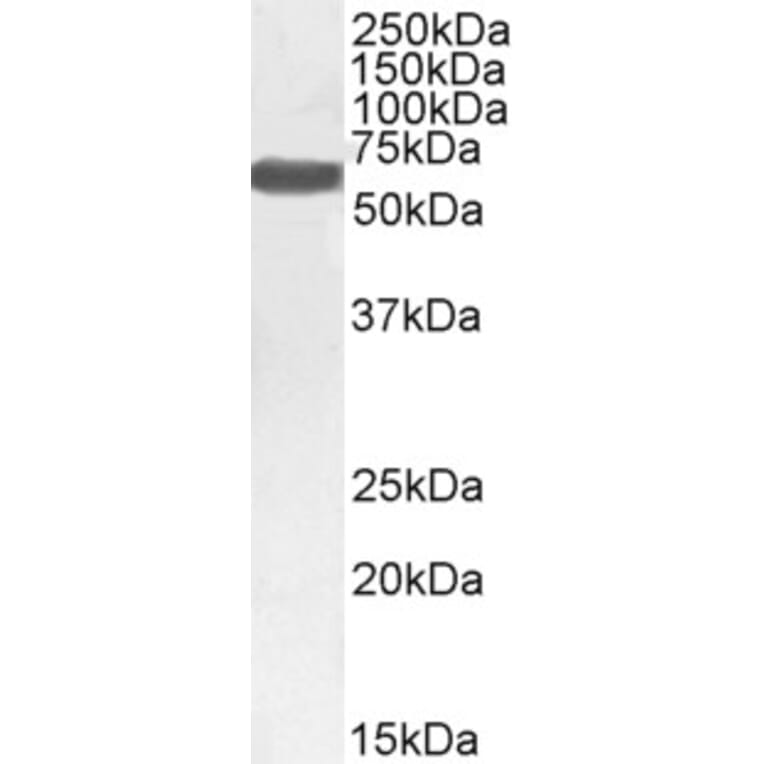 Western Blot - Anti-Monoamine Oxidase B/MAOB Antibody (A82500) - Antibodies.com