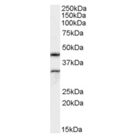 Western Blot - Anti-ACTL7B Antibody (A82502) - Antibodies.com