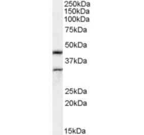 Western Blot - Anti-Actl7b Antibody (A82502) - Antibodies.com