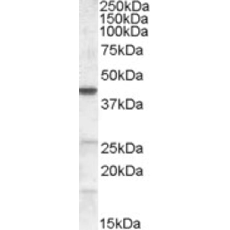 Western Blot - Anti-ABHD5/CGI-58 Antibody (A82503) - Antibodies.com