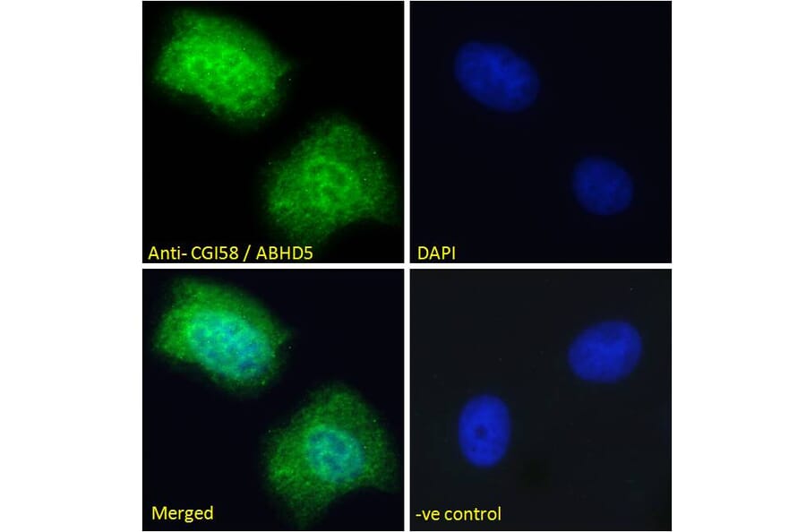 Immunofluorescence - Anti-ABHD5/CGI-58 Antibody (A82503) - Antibodies.com