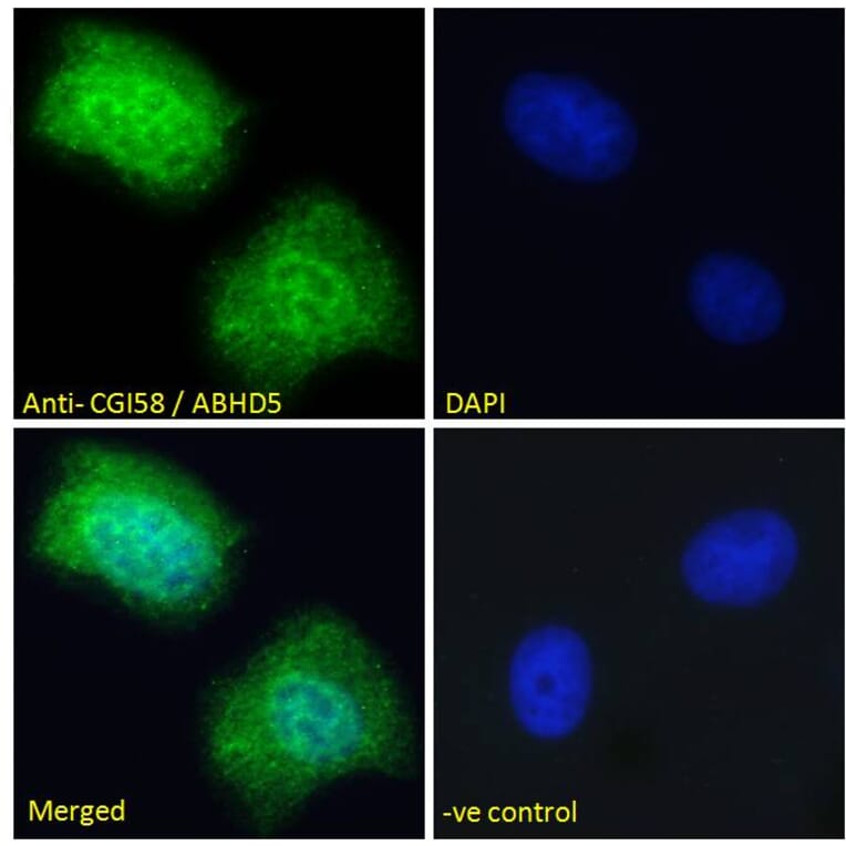 Immunofluorescence - Anti-ABHD5/CGI-58 Antibody (A82503) - Antibodies.com