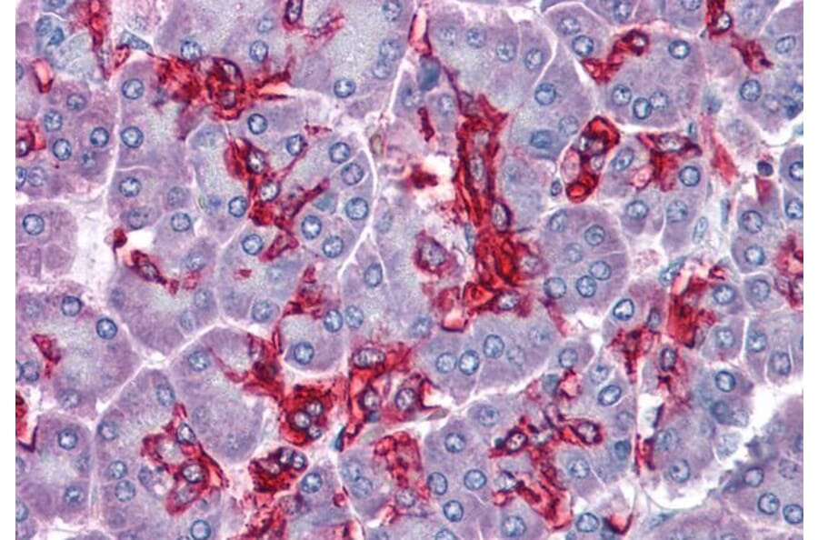 Immunohistochemistry - Anti-ABHD5/CGI-58 Antibody (A82503) - Antibodies.com