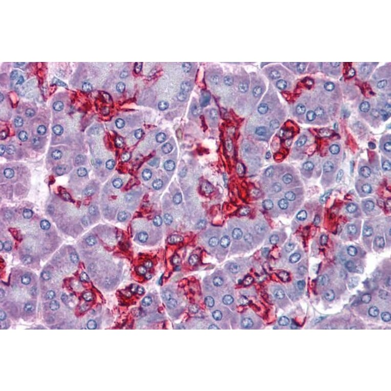 Immunohistochemistry - Anti-ABHD5/CGI-58 Antibody (A82503) - Antibodies.com