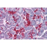 Immunohistochemistry - Anti-ABHD5/CGI-58 Antibody (A82503) - Antibodies.com