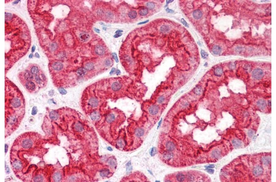 Immunohistochemistry - Anti-ABHD5/CGI-58 Antibody (A82503) - Antibodies.com