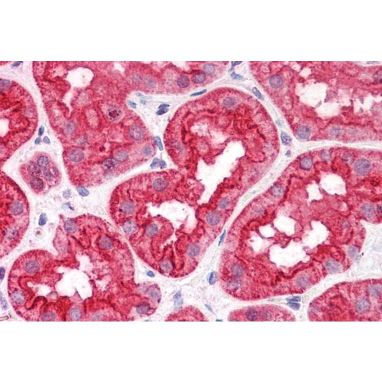 Immunohistochemistry - Anti-ABHD5/CGI-58 Antibody (A82503) - Antibodies.com