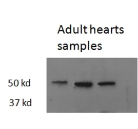 Western Blot - Anti-Thyroid Hormone Receptor beta Antibody (A82504) - Antibodies.com